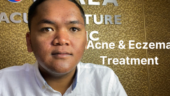 Acne & Eczema Treatment - Part 2